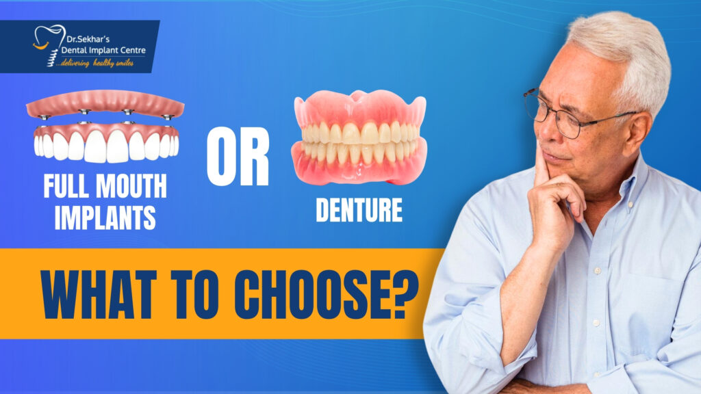 Full Mouth Implants or Dentures: What’s Right for You?